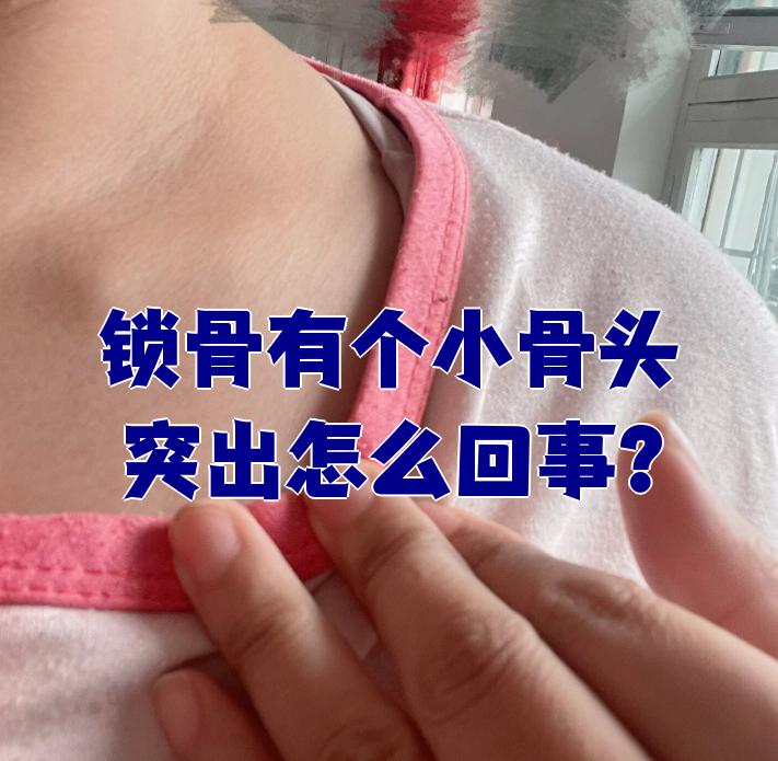 锁骨有个小骨头突出怎么回事?