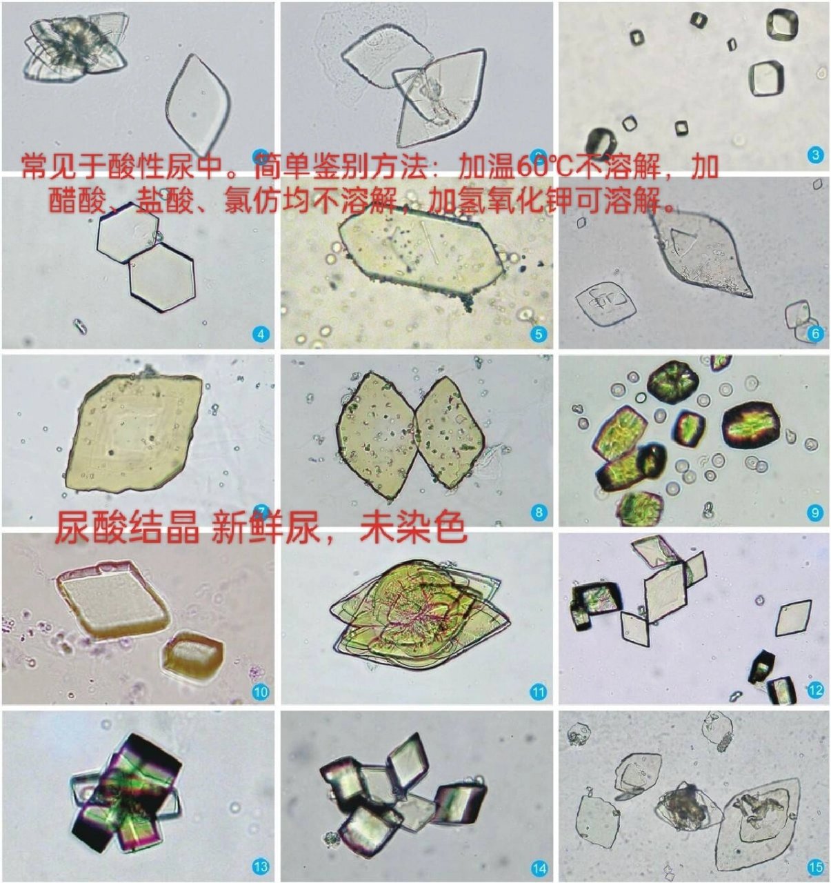 尿结晶图谱大全图片