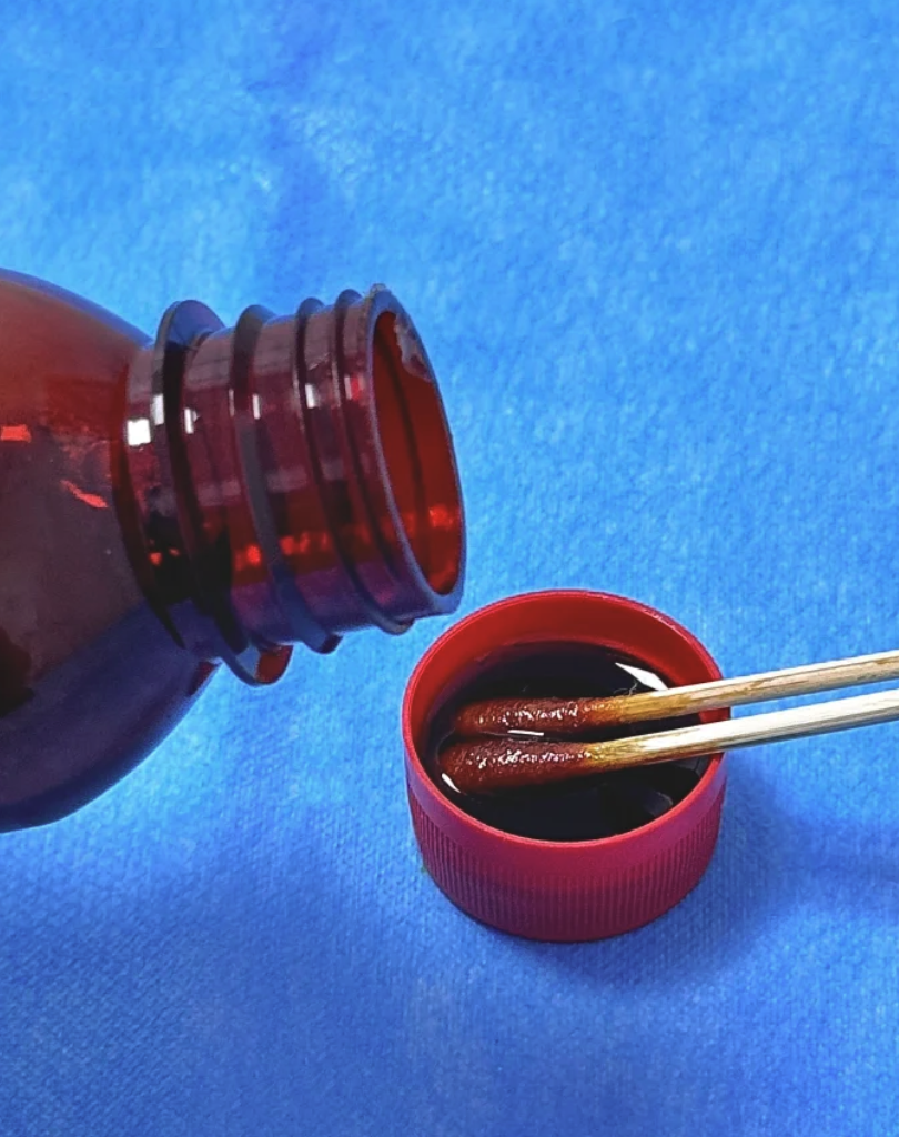 手术后如果发现缝线长到肉里拆不出来,可以用药物或手术来处理