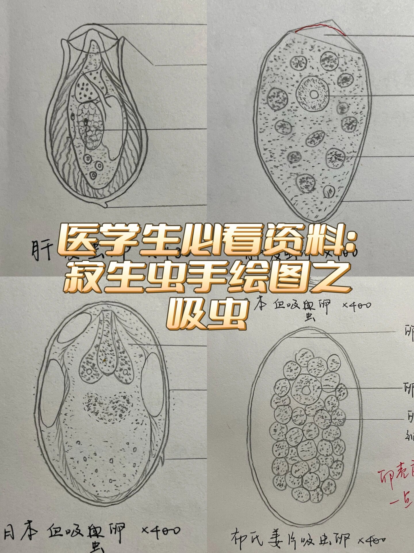 医学生必看:寄生虫手绘图