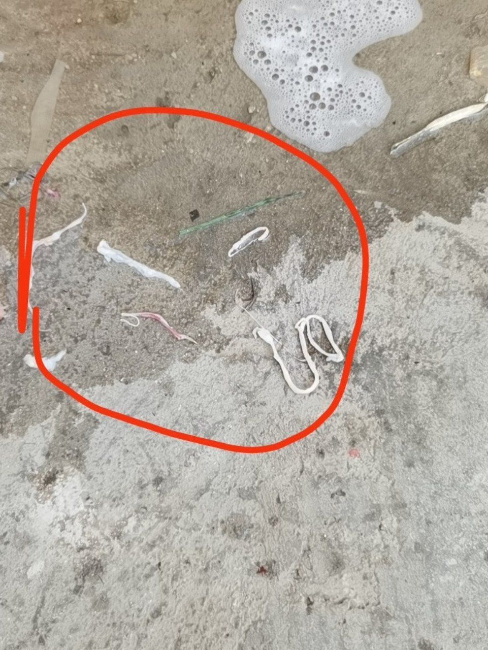 牛肉里的寄生虫 吃牛肉的朋友请注意了,解冻后的牛肉最容易看到寄生虫