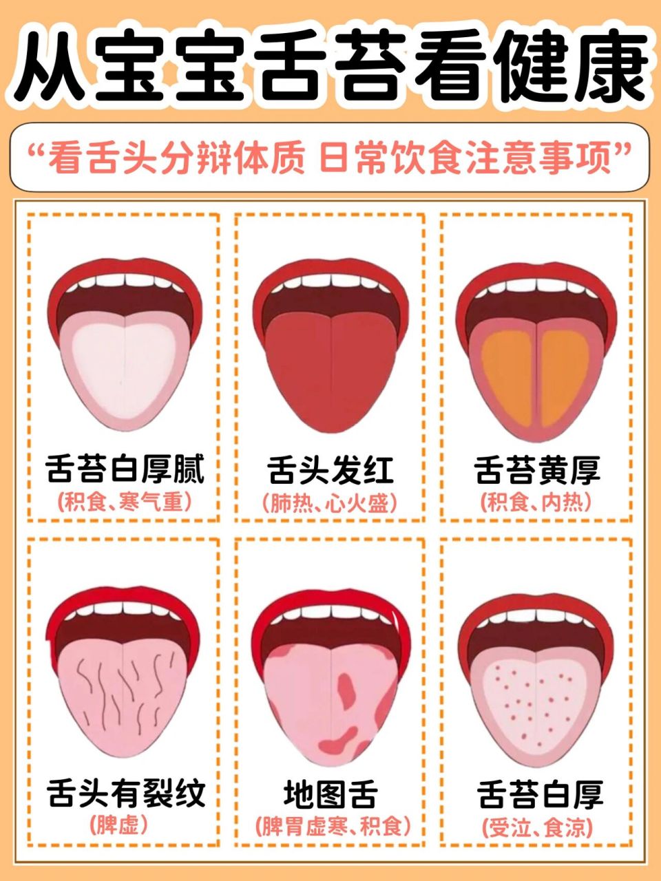 新手爸妈一定要学会6015 - 93症状1:舌苔黏厚,呈黄白色 73