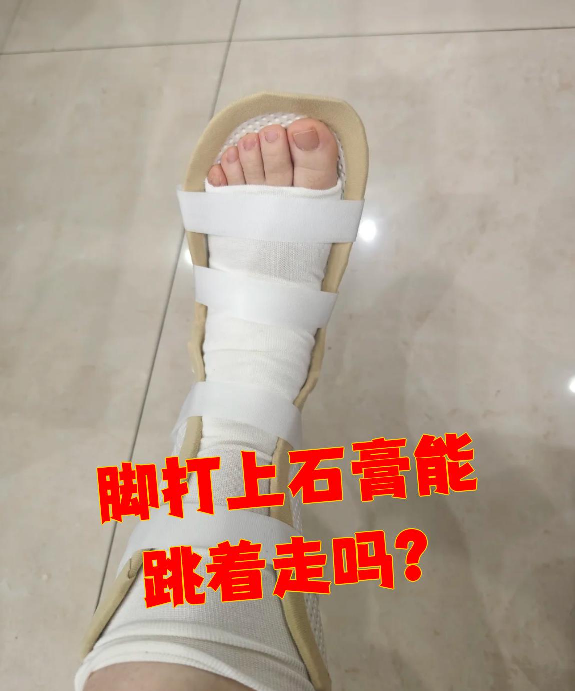 骨折为什么要打石膏再做手术为什么在线 骨折为什么要打石膏再做手术为什么在线