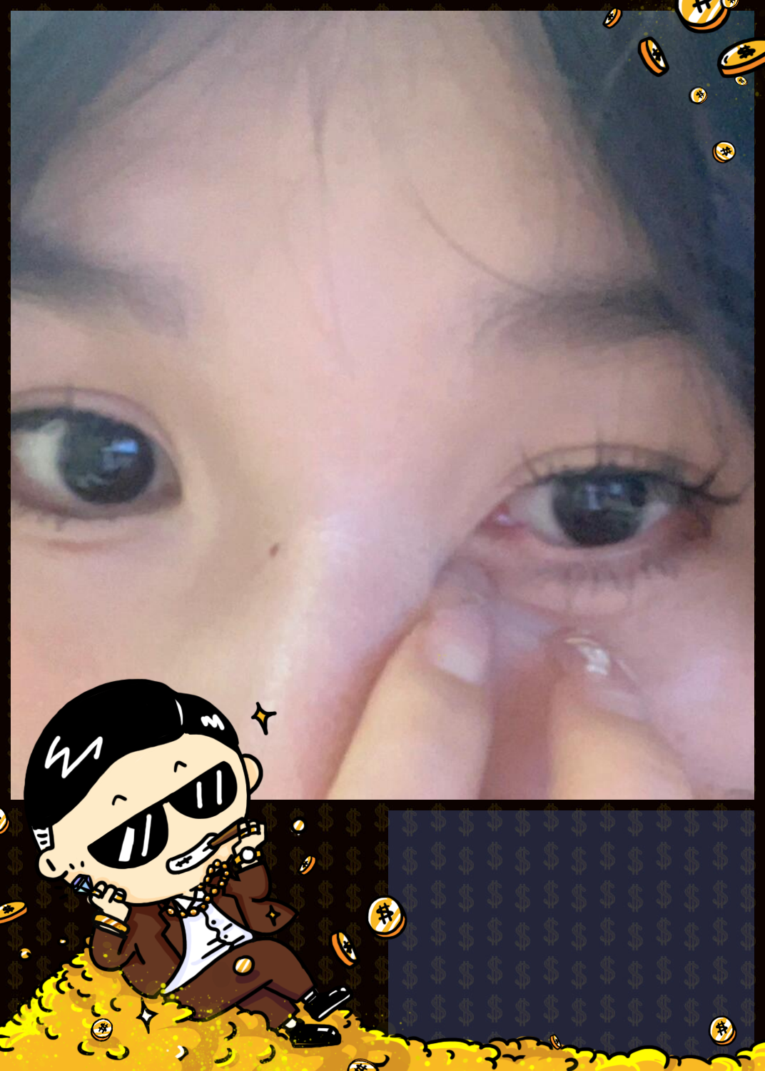 今天被一只臭屁虫袭击了 它飞到我眼睛里,瞬间刺痛,我本能地闭眼,流泪