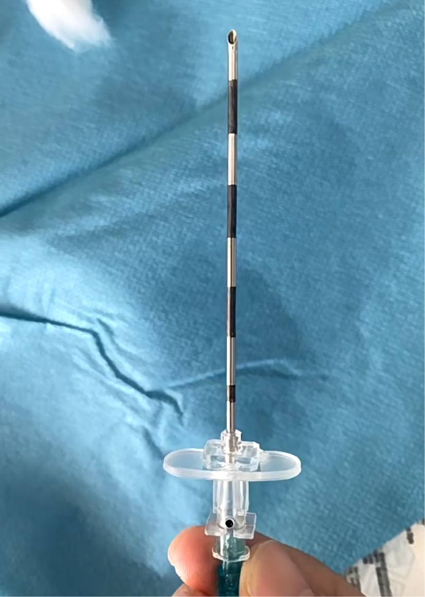 无痛人流的麻醉针通常打在患者手背或手腕的静脉位置