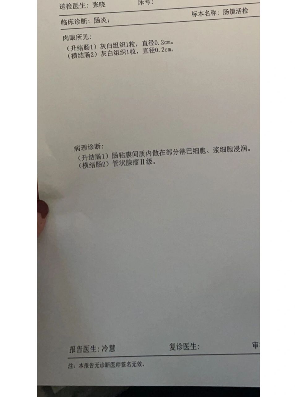 肠息肉病理检查 一个是炎性息肉,另一个是2级管状腺瘤.吓哭了.