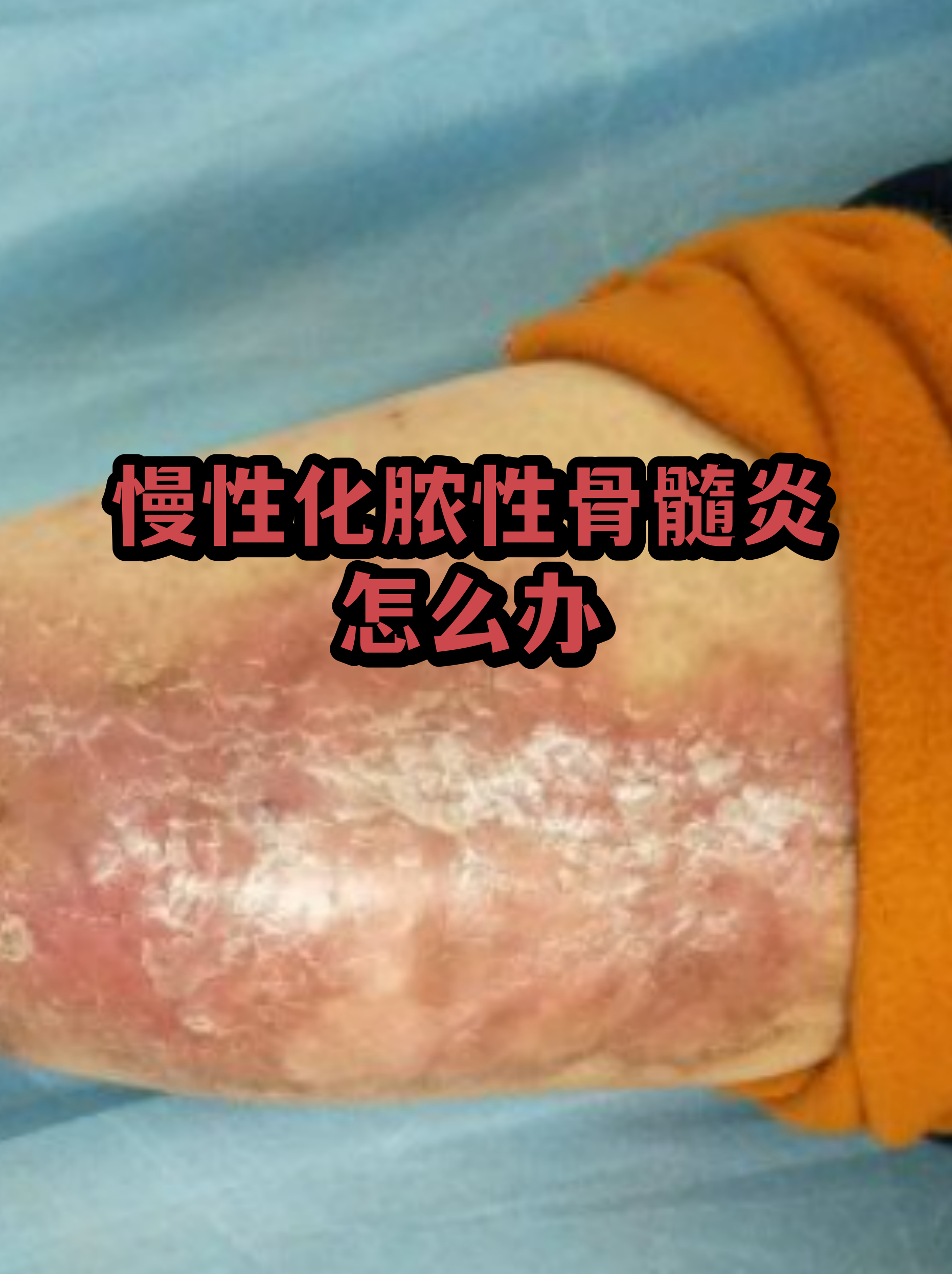 301医院预约挂号陪诊一体复杂病情综合分析，治疗方向更明确的简单介绍