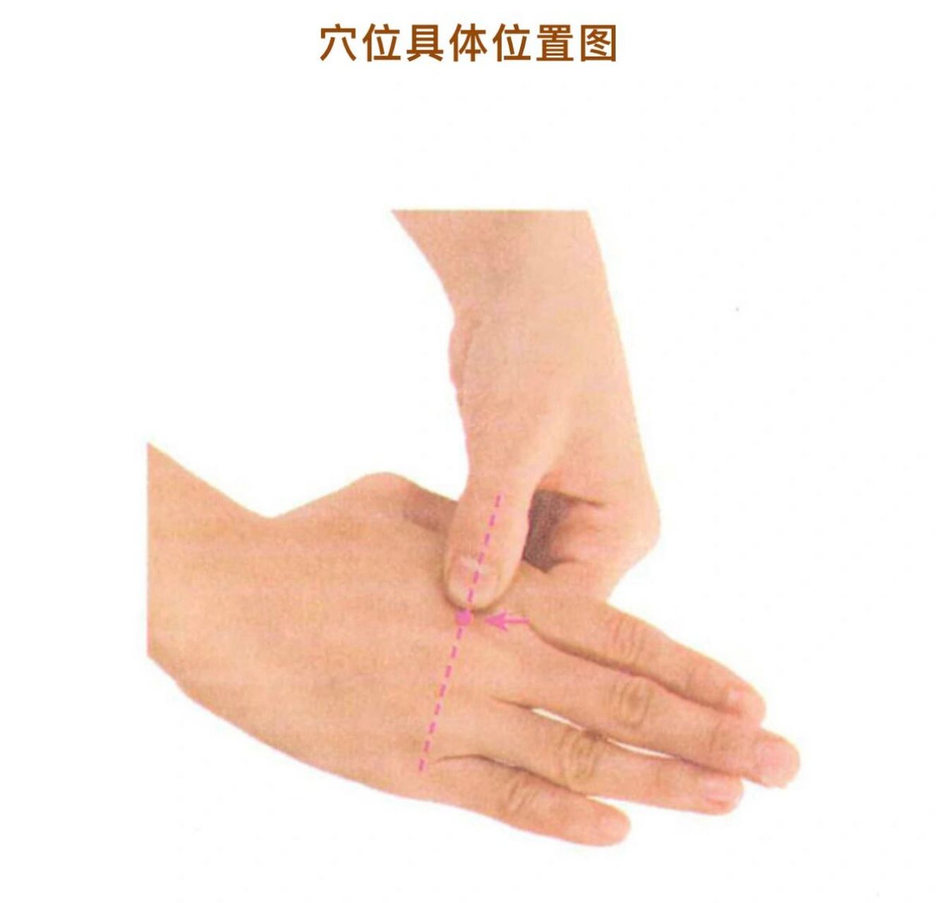 【每日一穴】外劳宫穴:属经外奇穴;主治:落枕, 【每日一穴】外劳宫穴