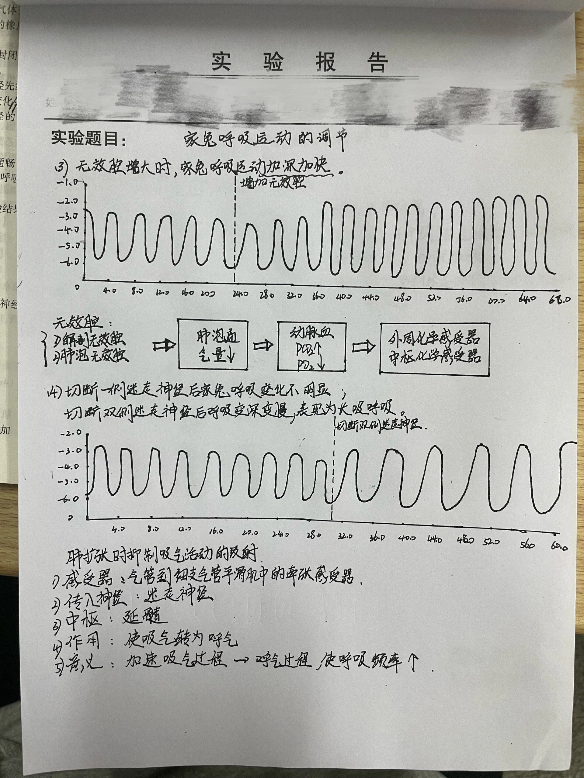 家兔正常血压曲线图图片