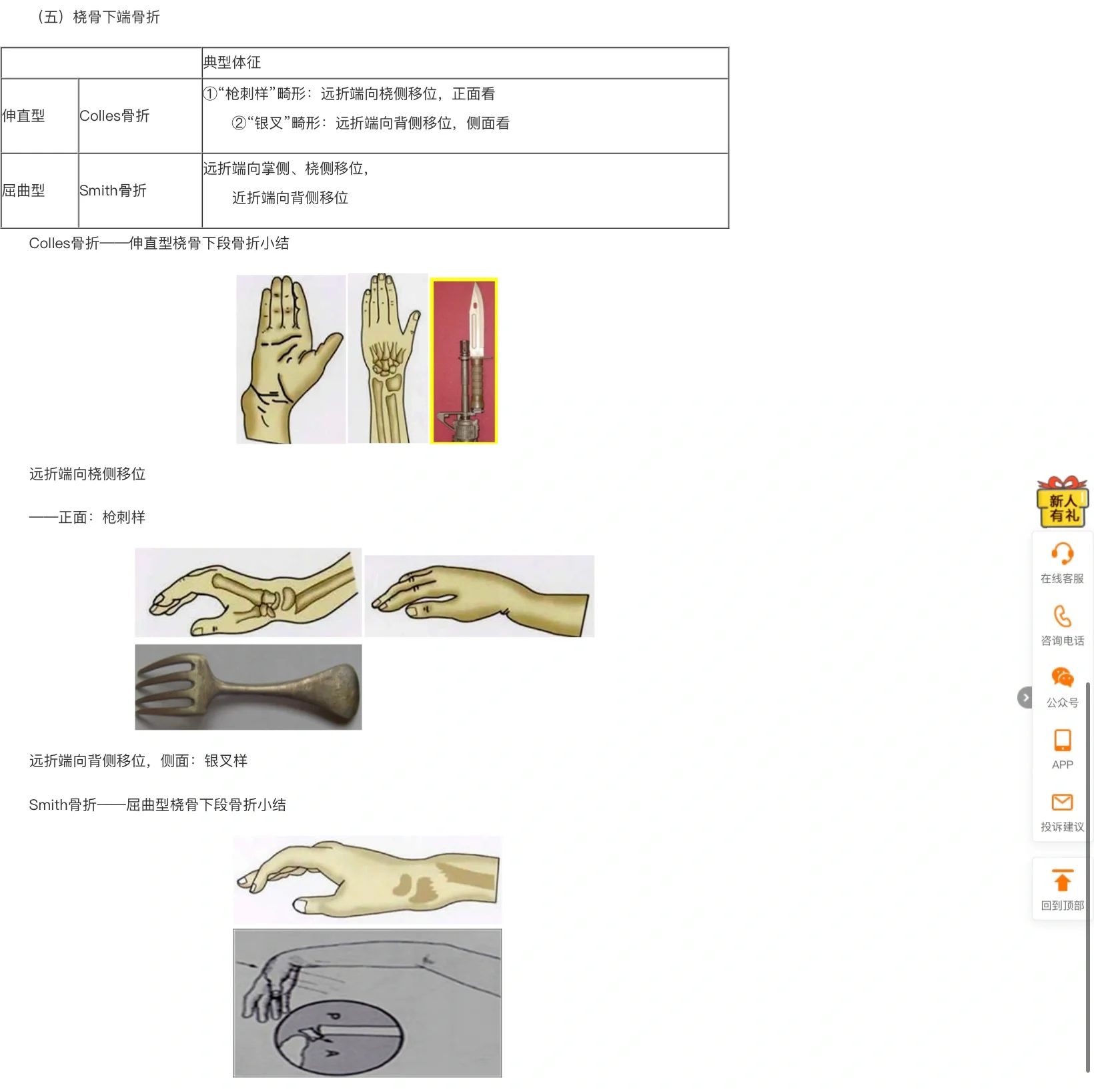 colles与smith骨折图解图片