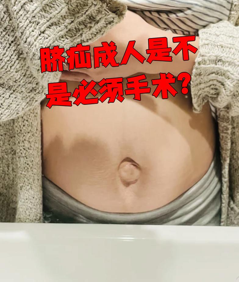 成人脐疝通常需要手术