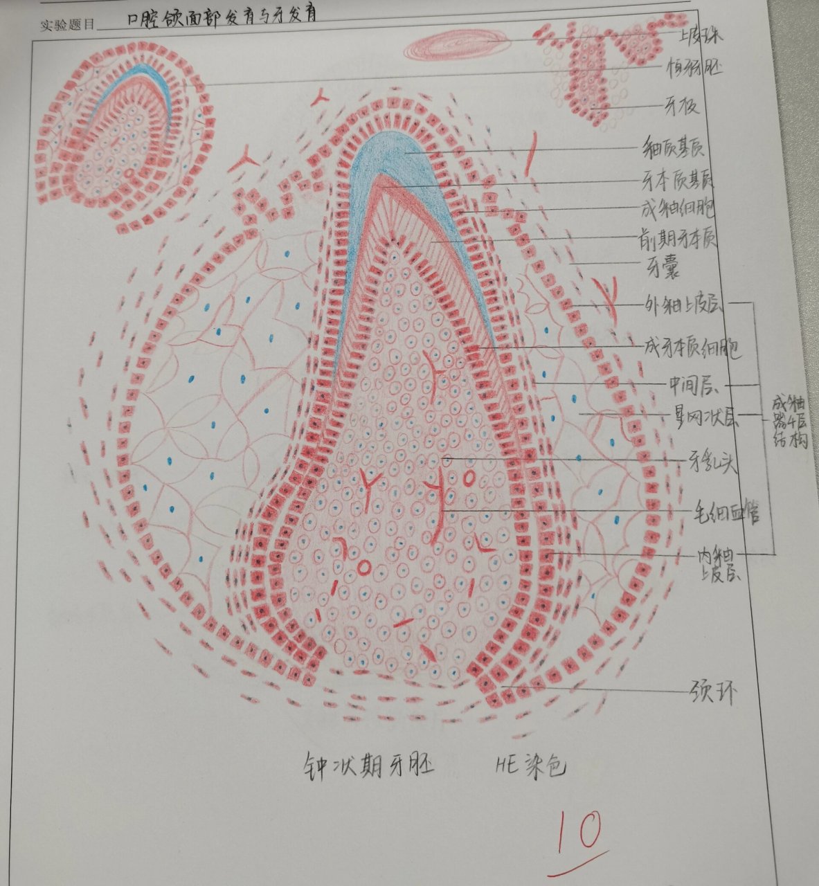 红蓝铅笔绘图 钟状期牙胚 牙釉质纵横断面磨片 根尖肉芽肿 寻常型天
