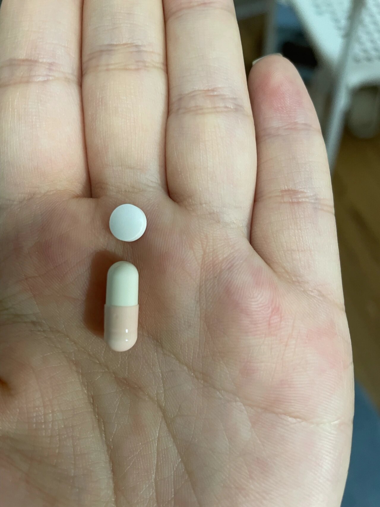 咱就说吃了氟西汀胃口大开是什么情况