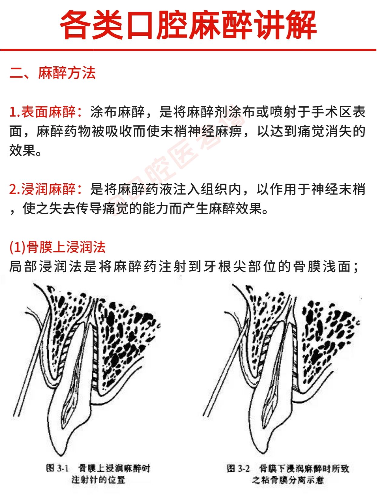 口腔麻醉神经分布图片图片