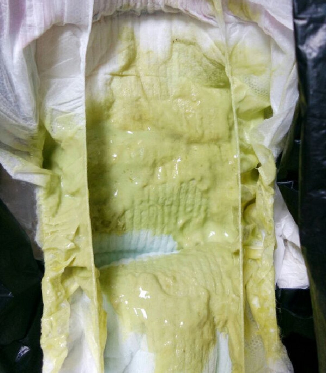 从照片我们可以看出: 	 大便粉状,灰白色,建议就医检查.