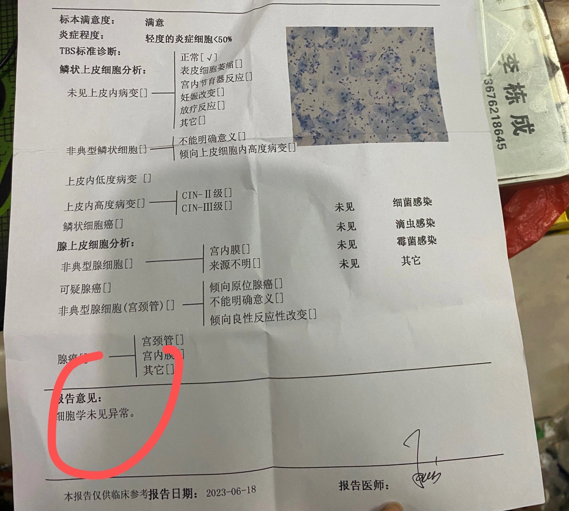 非典型鳞状细胞意义不明确 时隔3个月的今天去复查tct正常了,3月份