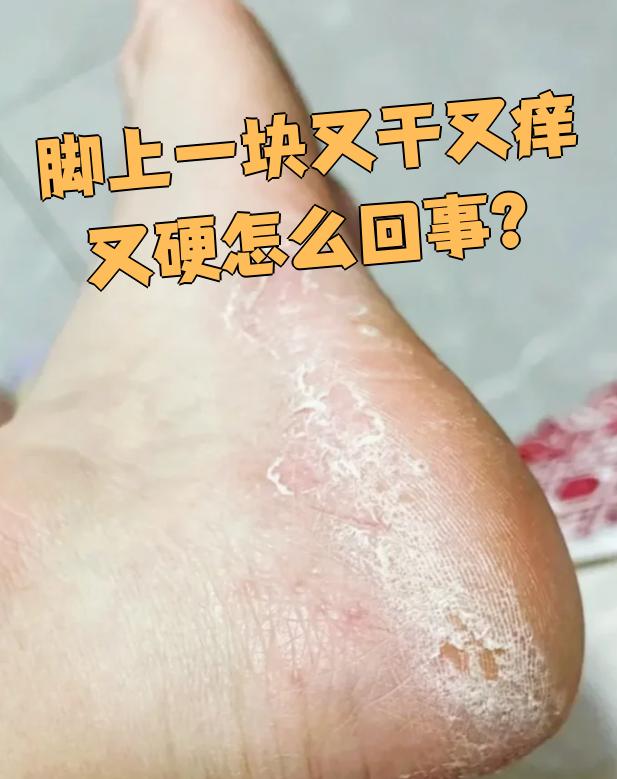 如果症状长时间不消退或加重,建议尽快就医检查