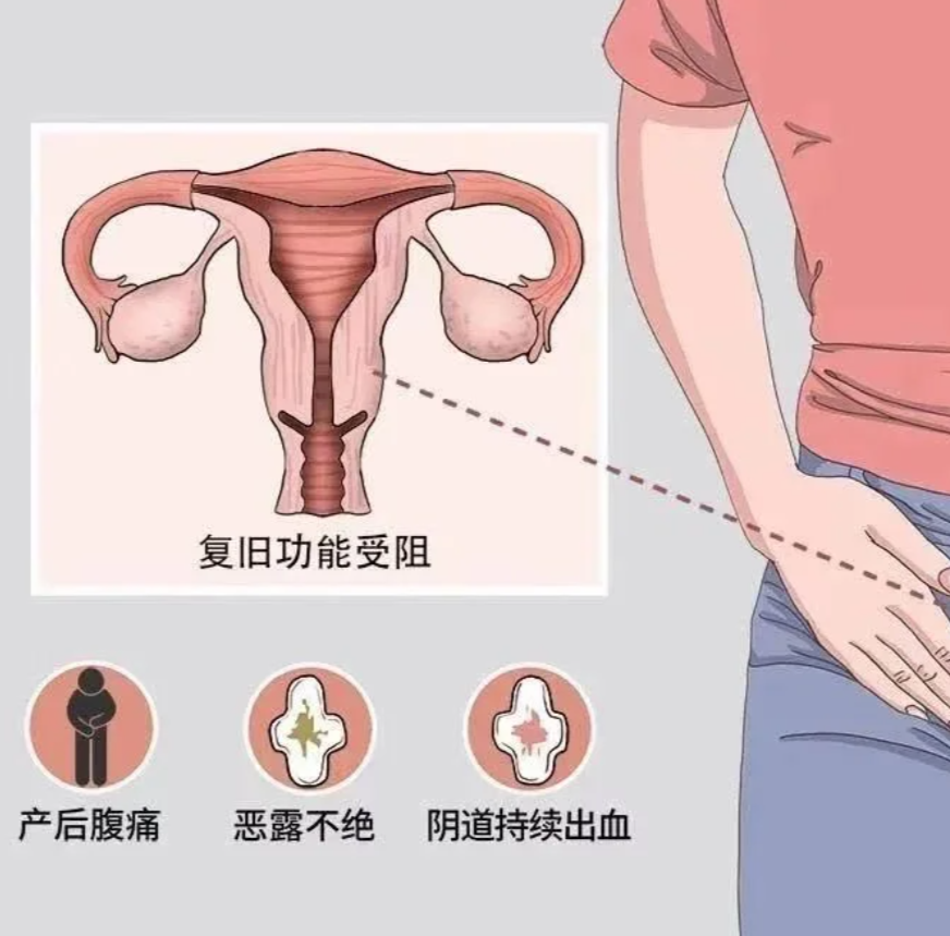 为什么有宫缩 为什么有宫缩