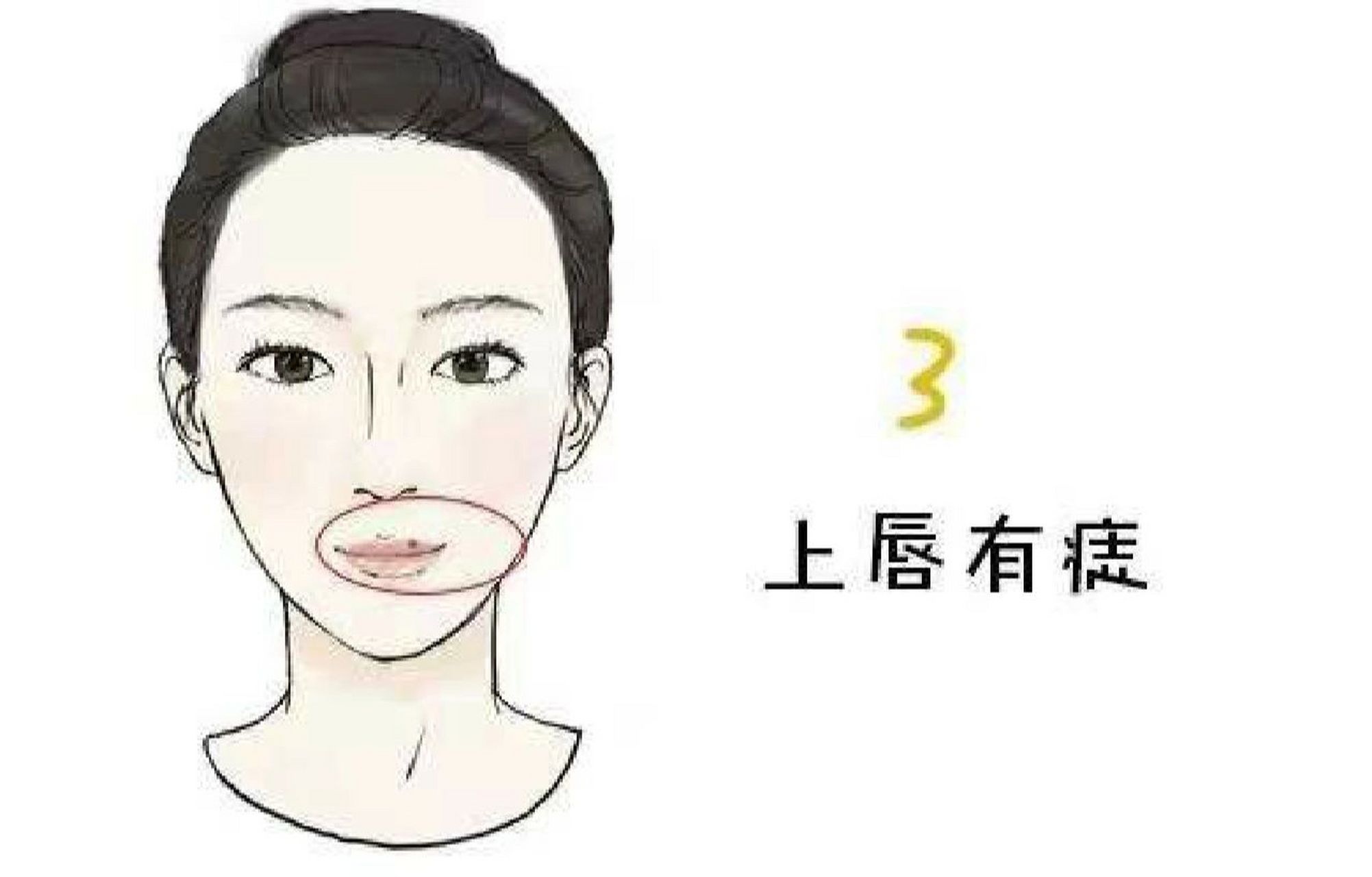 嘴唇痣其实也是桃花痣的一种 嘴唇痣其实也是桃花痣的一种 若上嘴唇有