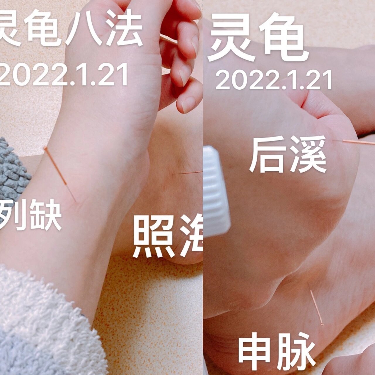 针灸练习第5周 练习灵龟八法 晚上课 先后溪配申脉 然后照海配列缺 1.