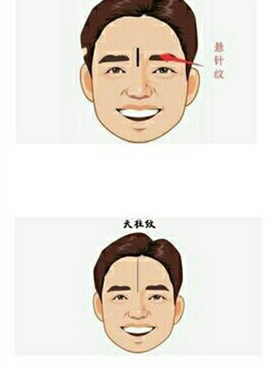 不要傻傻分不清 951,位置的不一样 天柱纹的位置明显要比悬针纹要高