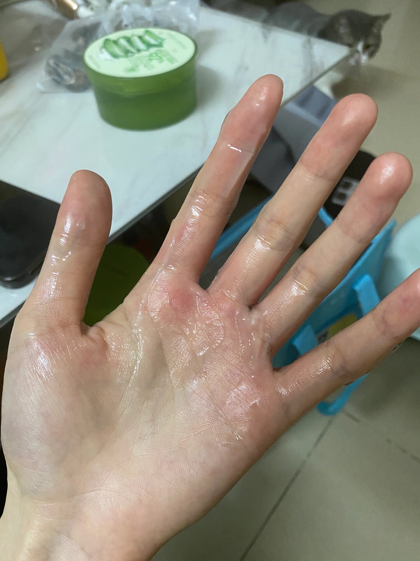 晚上手被烫伤了(被自己蠢哭的一天) 痛到睡不着,一阵阵灼烧的感觉