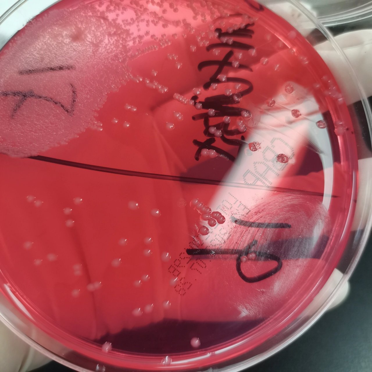 合格痰的标本长出大量的鲍曼不动杆菌菌!浅谈一下它的临床意义