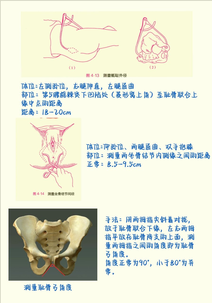 产科检查之四部触诊,骨盆外测量 四部触诊的目的 ①判断胎产式,胎方位