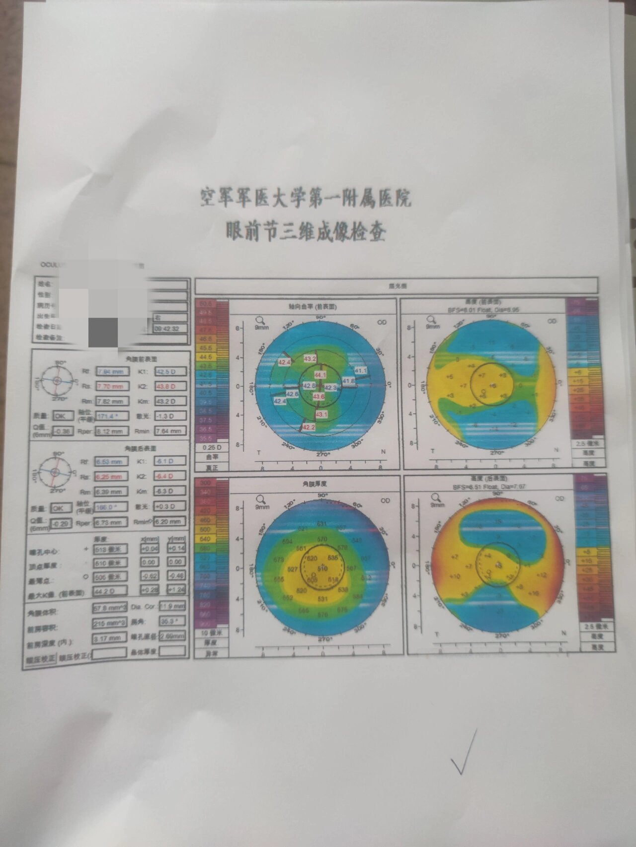 角膜地形图上看kappa角图片