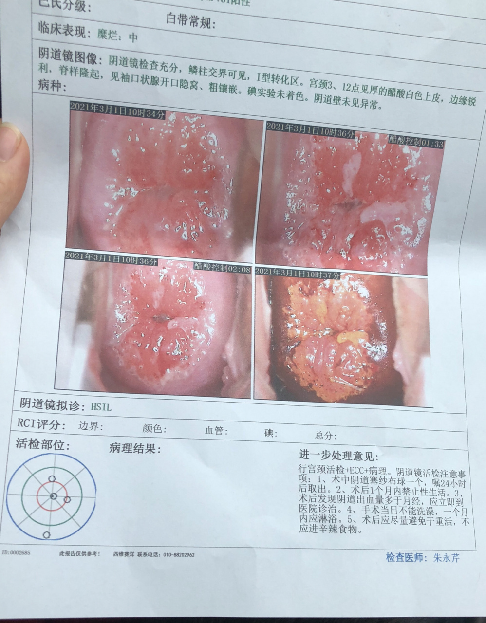阴道镜取活检 阴道镜取活检做完了,送病理科办了加