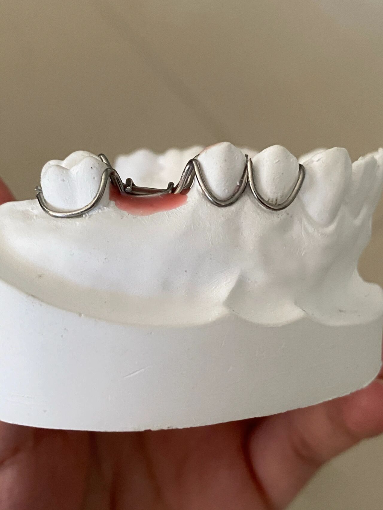 口腔医学日常|三臂卡环弯制@天天稷下湖的动态