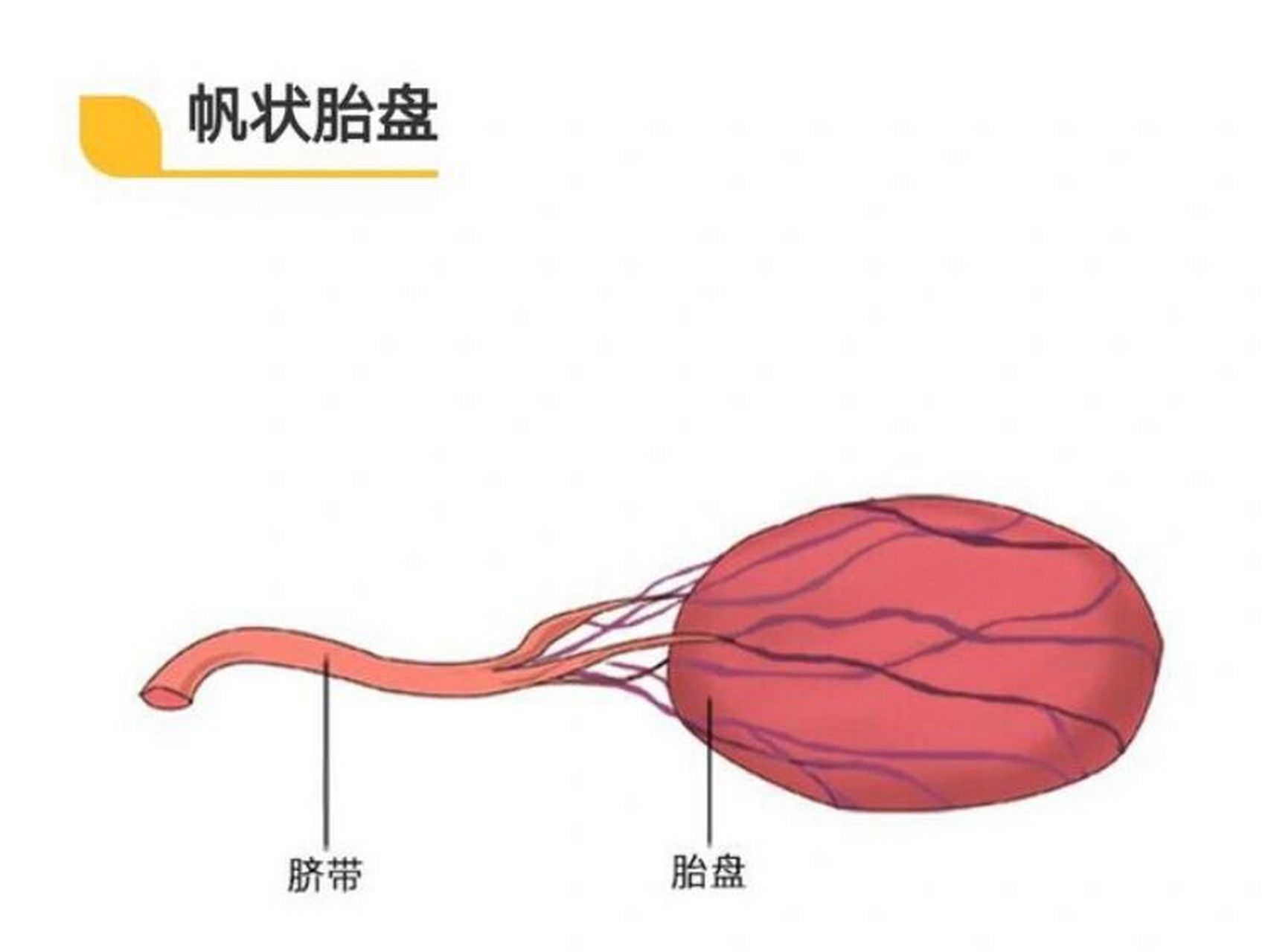 关于帆状胎盘和孕晚期生长受限(下) 后来大夫来查房,我问大夫我那个