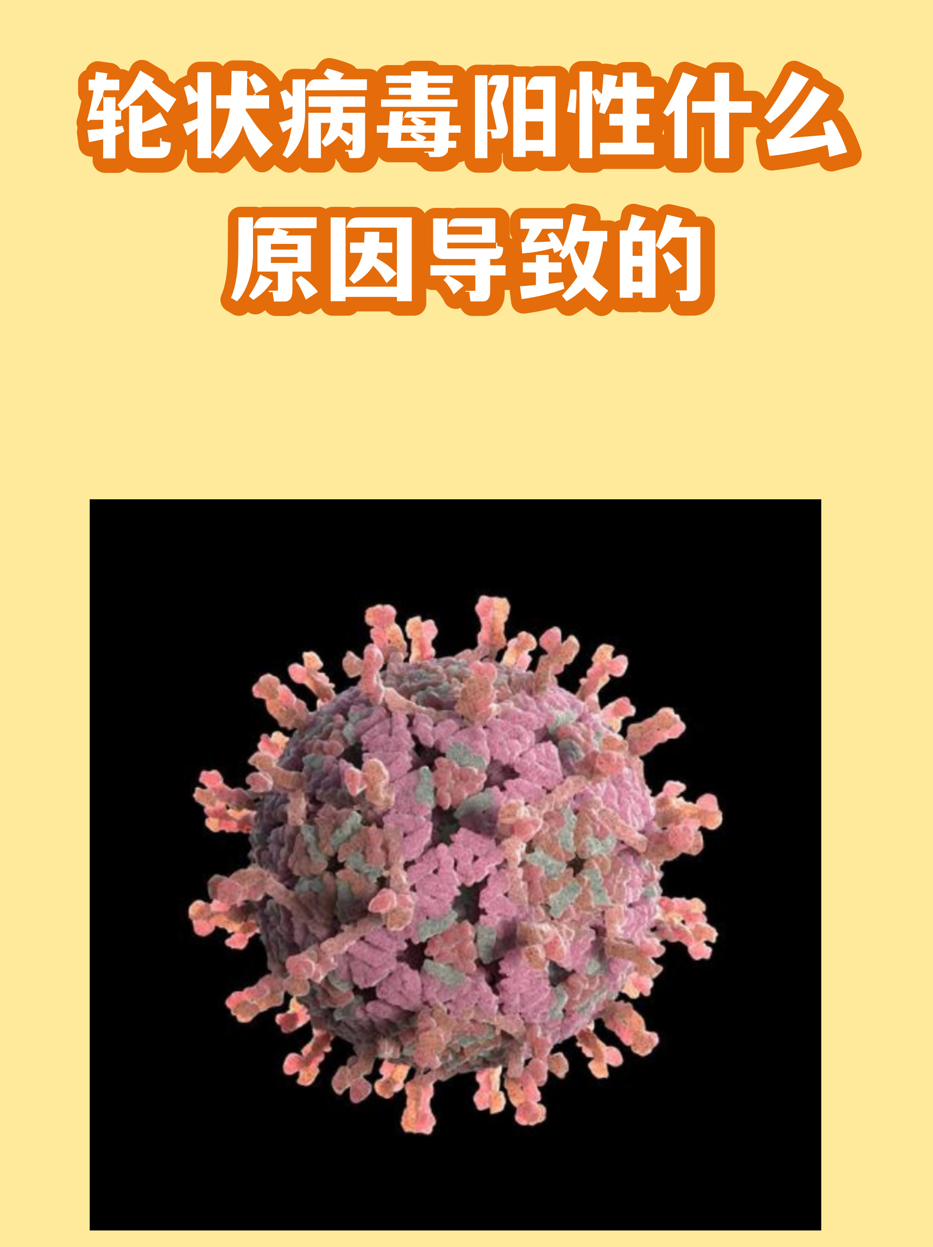疫情是什么类型的病毒引起的呢图片的简单介绍