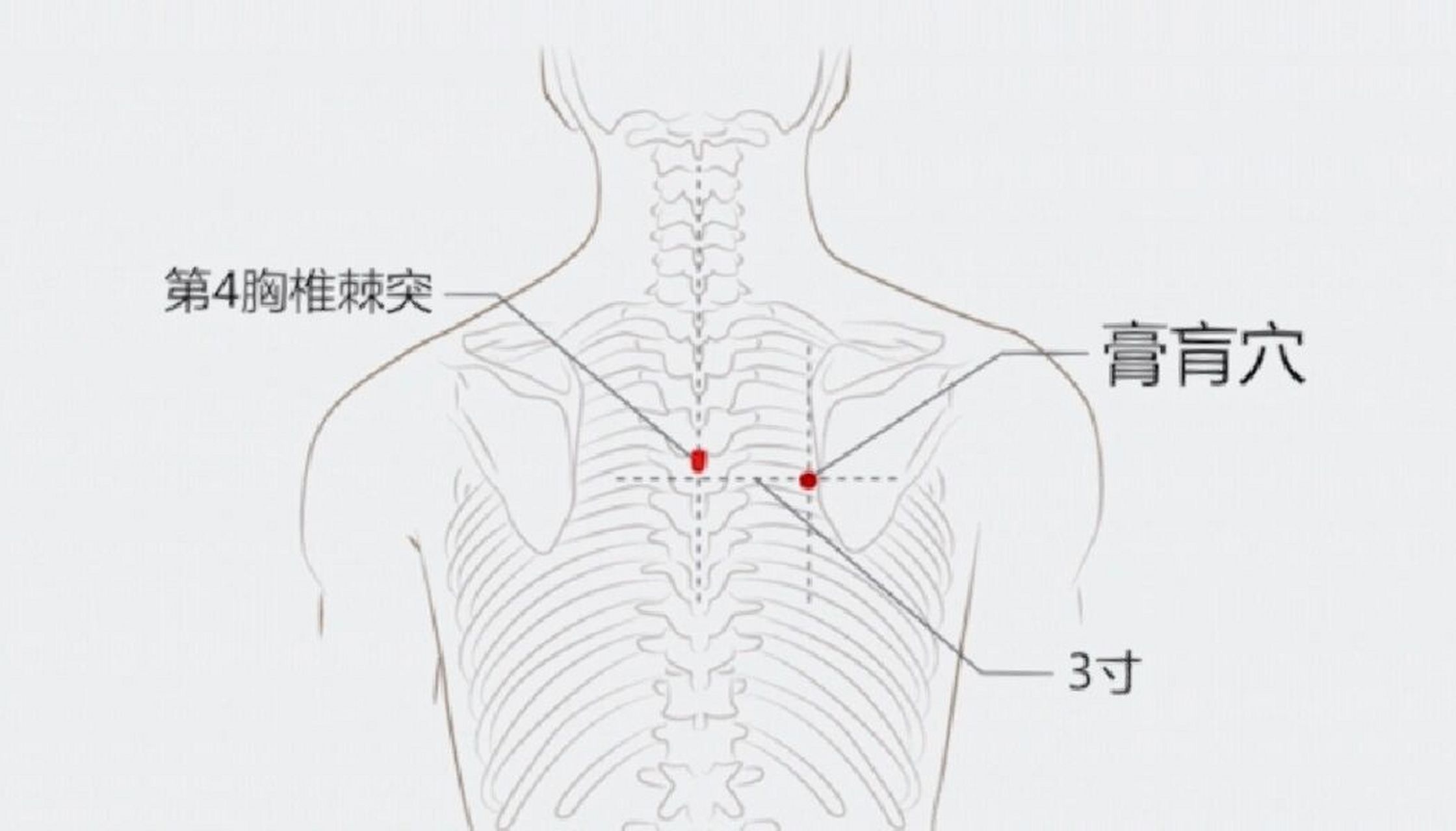 《千金要方》:"膏肓俞,无所不治,主羸瘦虚损,梦