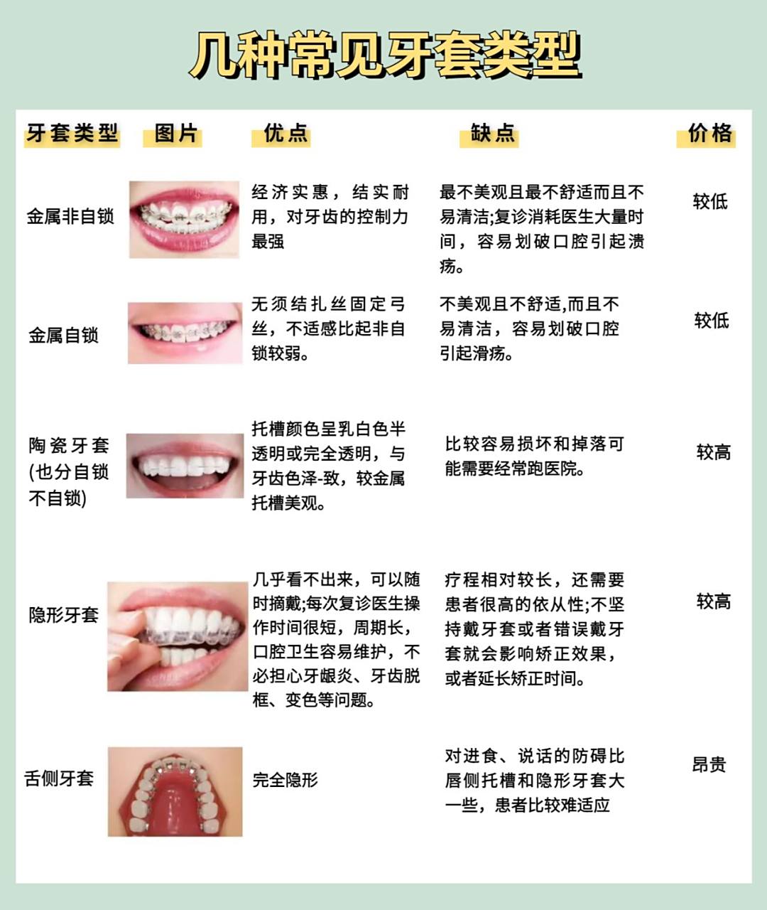 几种常见牙套类型!