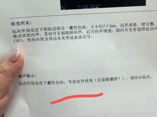 皮脂腺囊肿是一种常见的皮肤良性病变,也叫"粉瘤"
