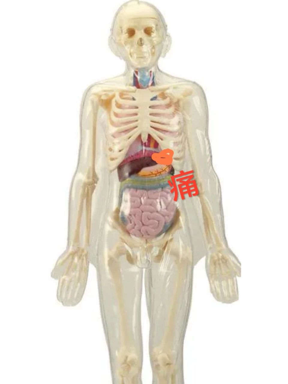 新冠后左胸下痛的一种可能 新冠后左胸下痛,我一