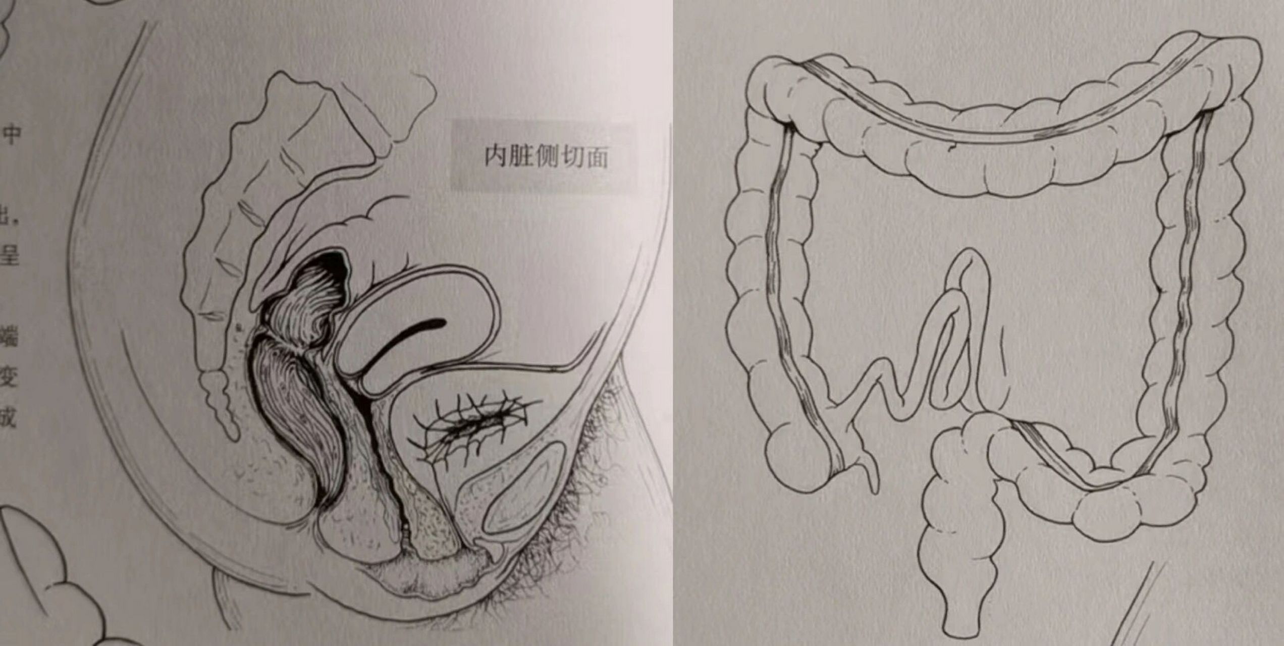 大肠素描图图片