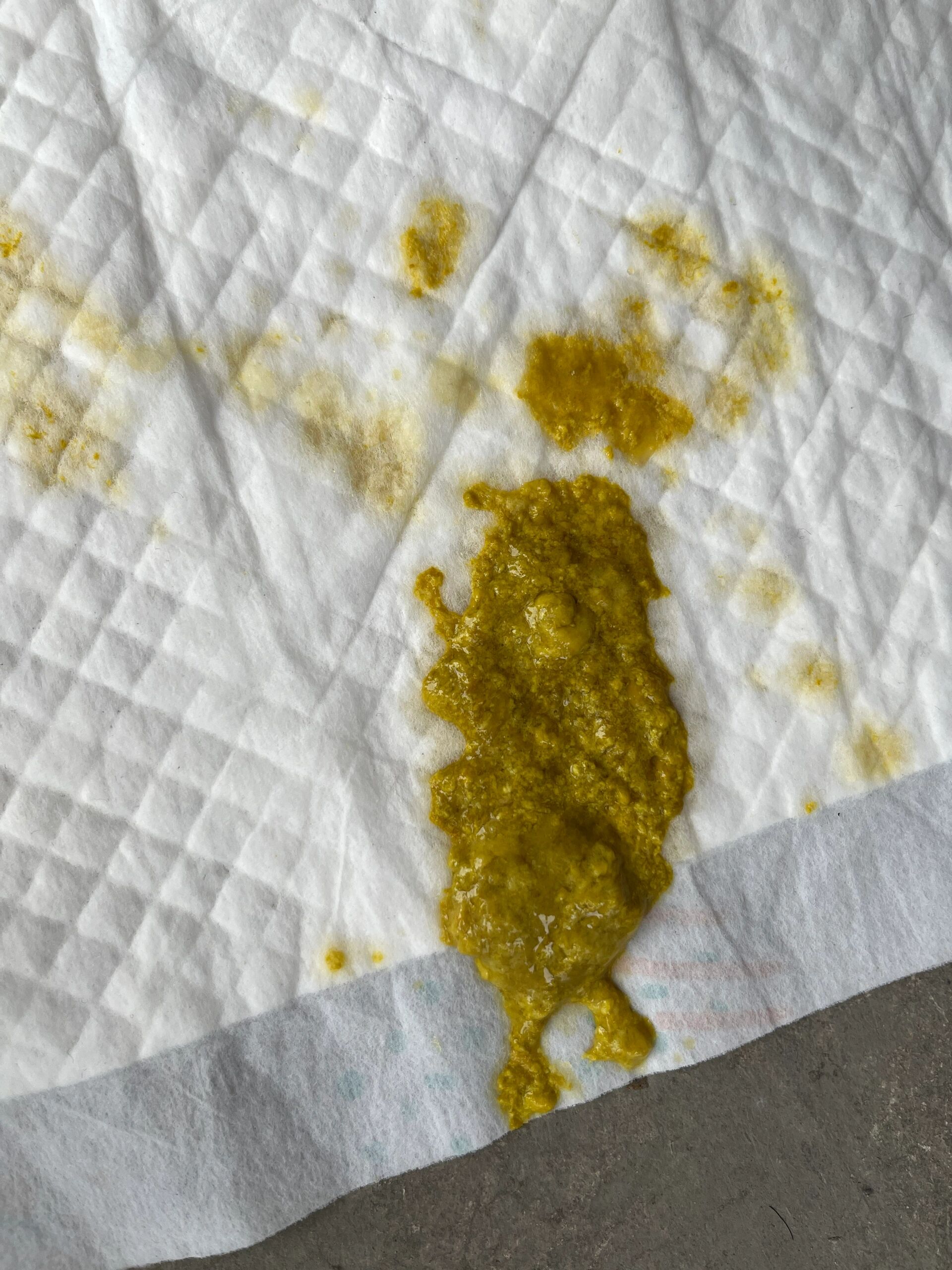 九个月的宝宝 一天拉三次正常吗 宝宝之前大便一天一次 ,就是从5月2号