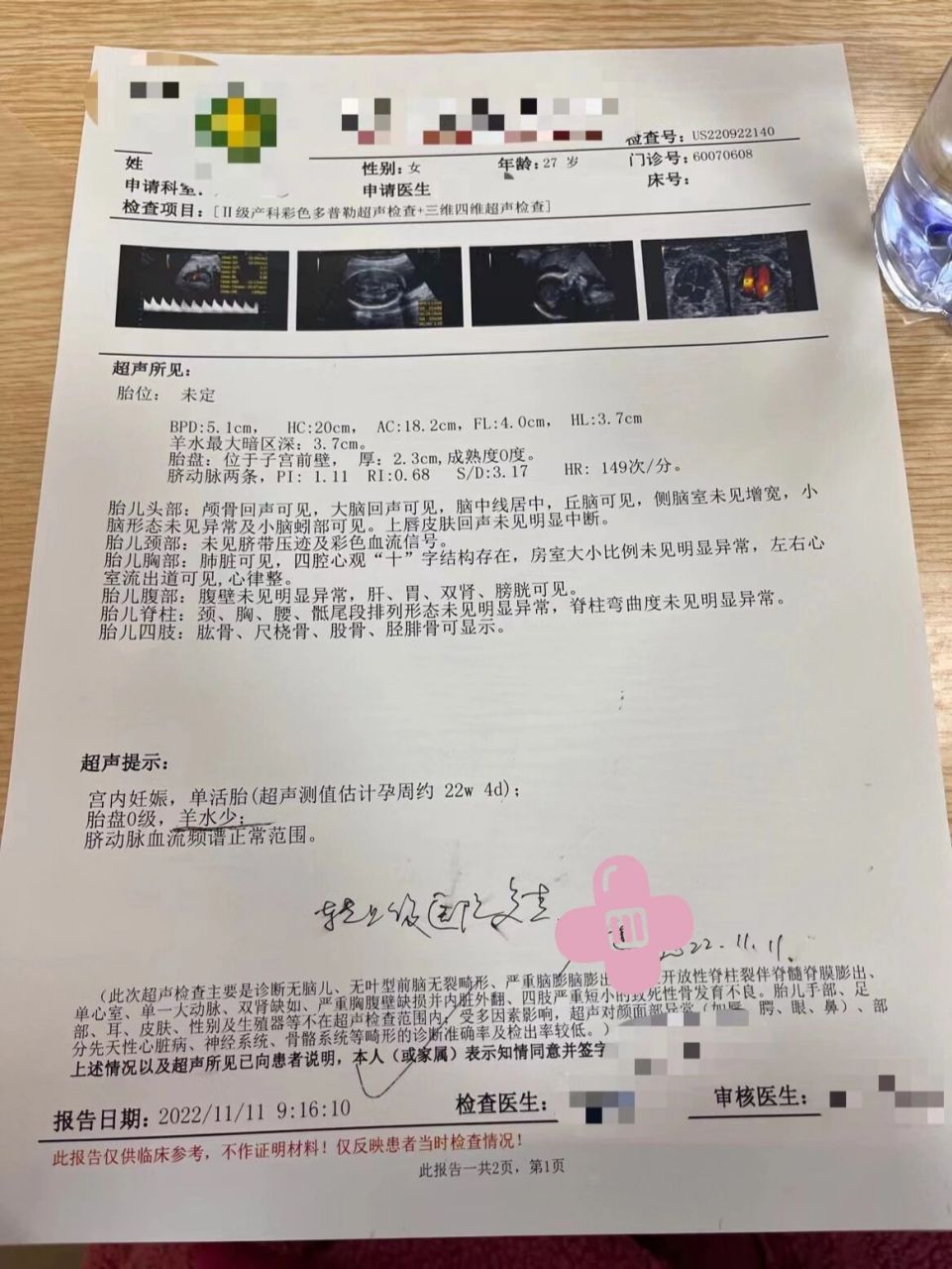 11月11约的四维,做的时候宝宝不配合,很多数值医生说不好测量,一直搓