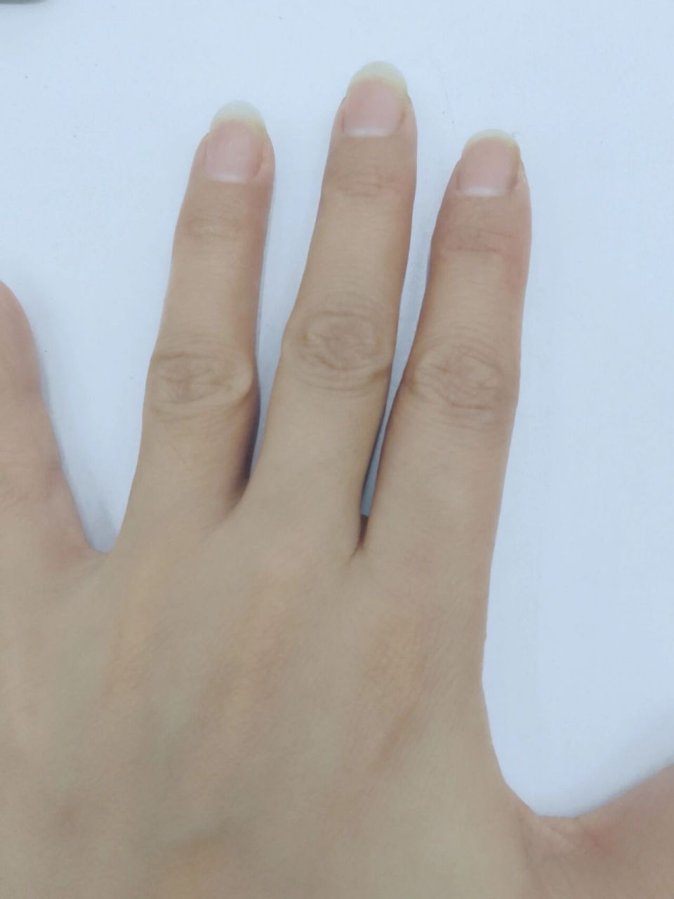 两个手的中指关节处疼 去年的时候,两个手的食指中指无名指,等于加