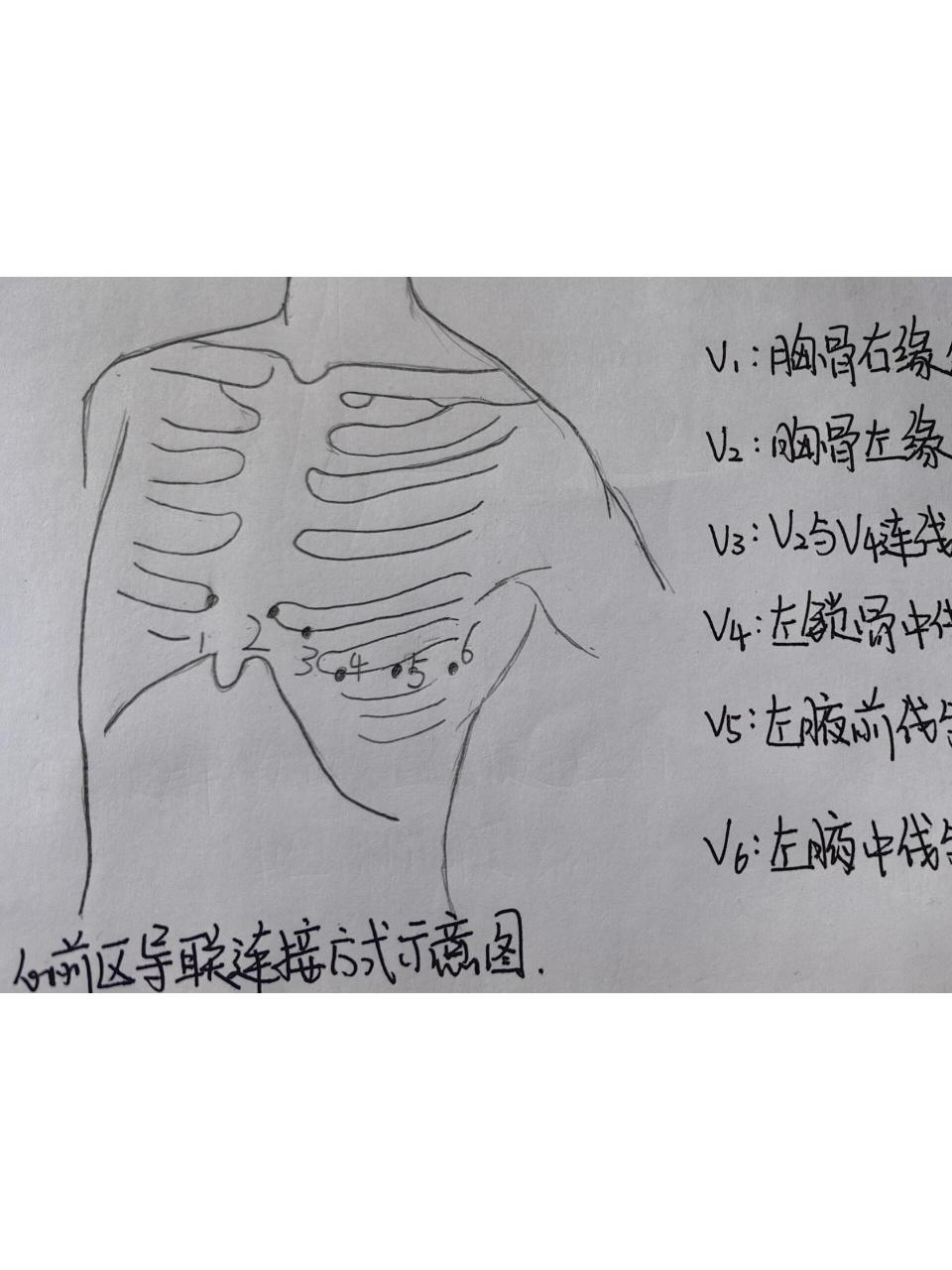 胸导联位置图片图片