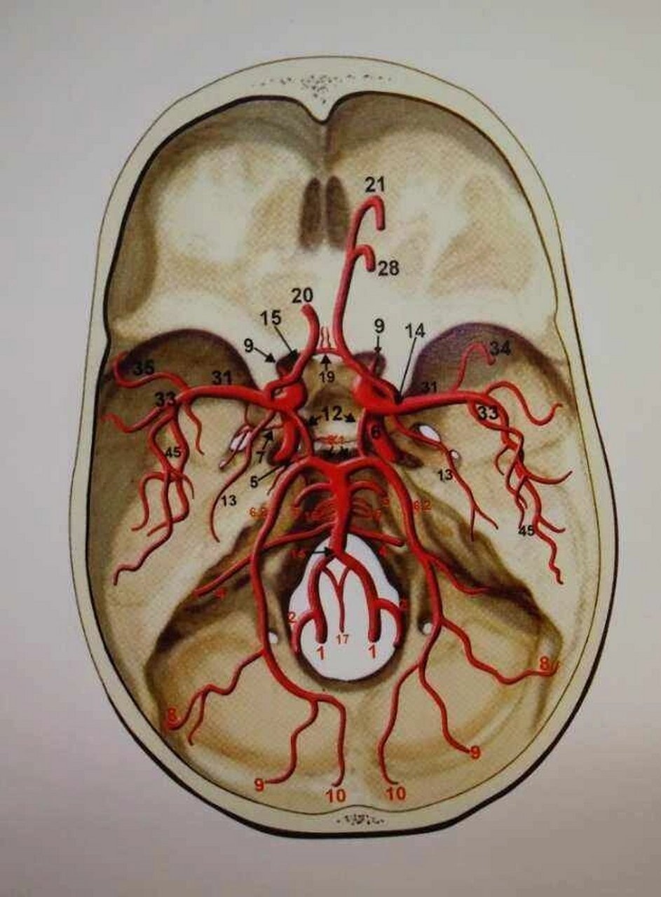 大脑动脉环影像图图片