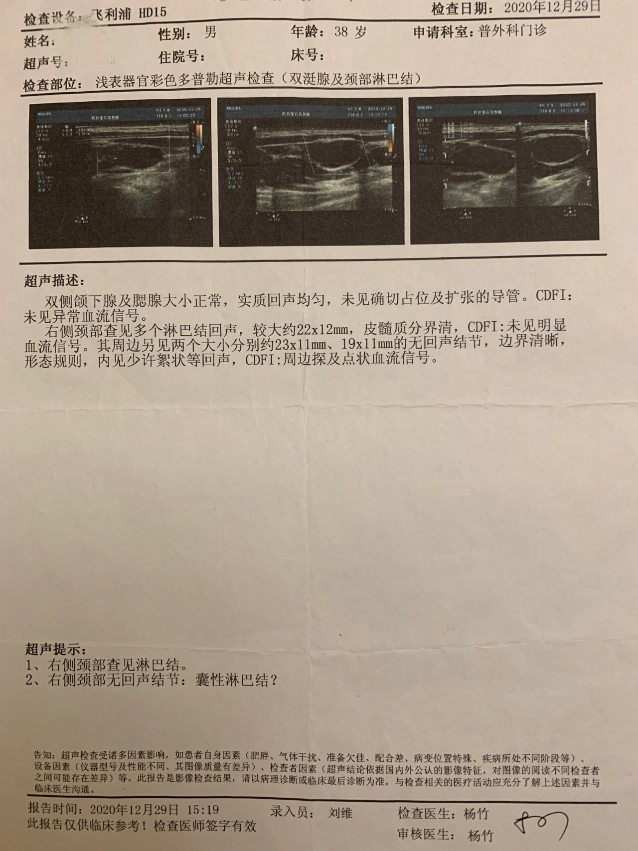 很多留言问摸到淋巴肿大严不严重
