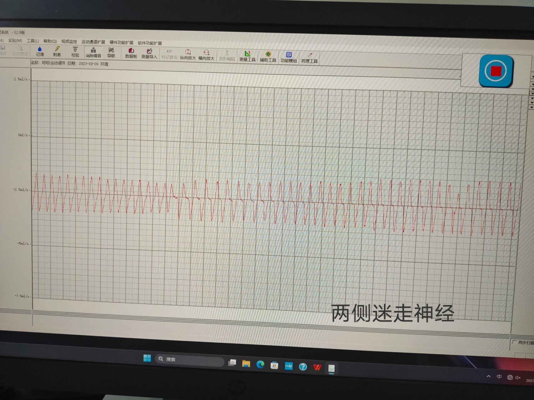 家兔正常血压曲线图图片