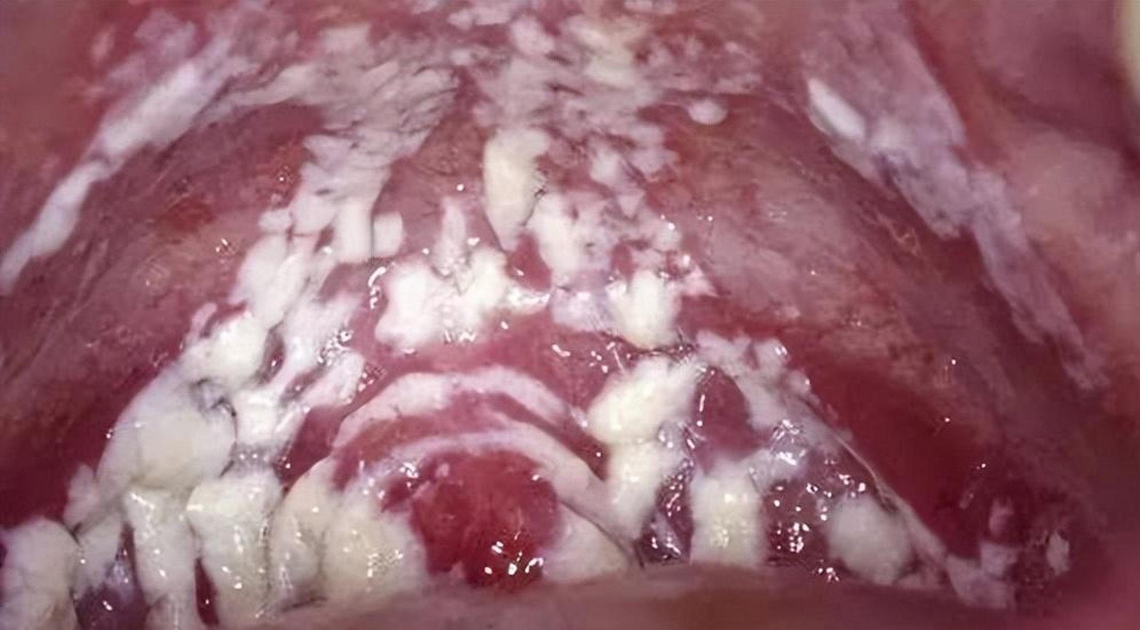 女性白带的四大作用 1,润滑作用 正常情况下,女性私处都是处于闭合的