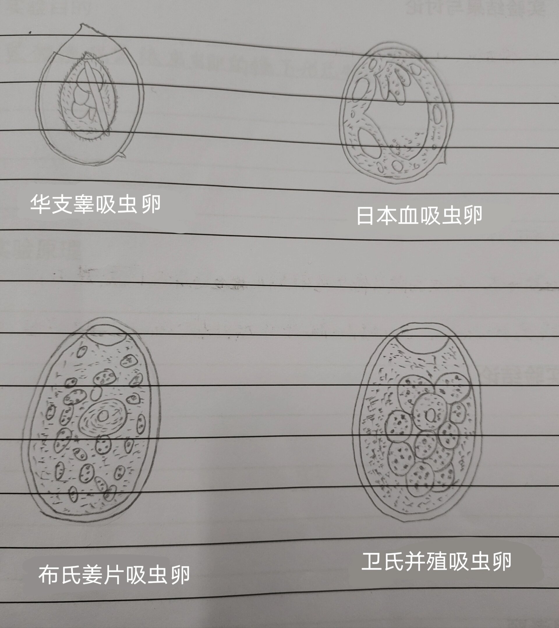 卫氏并殖吸虫卵