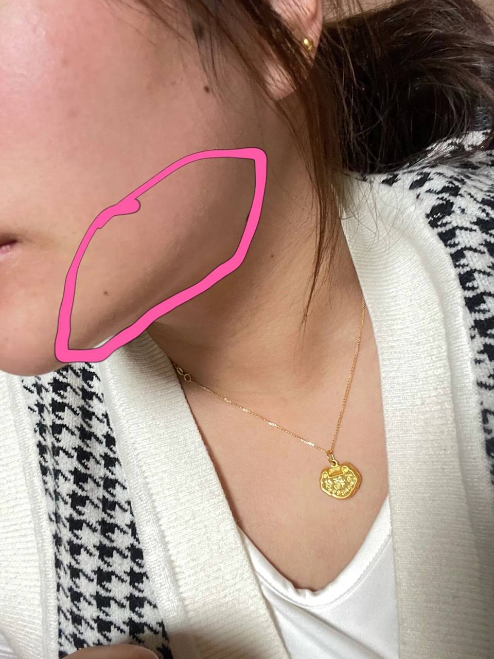 脸颊两侧下颚线附近都痒,头发碰到都痒 也不长痘,就是痒!