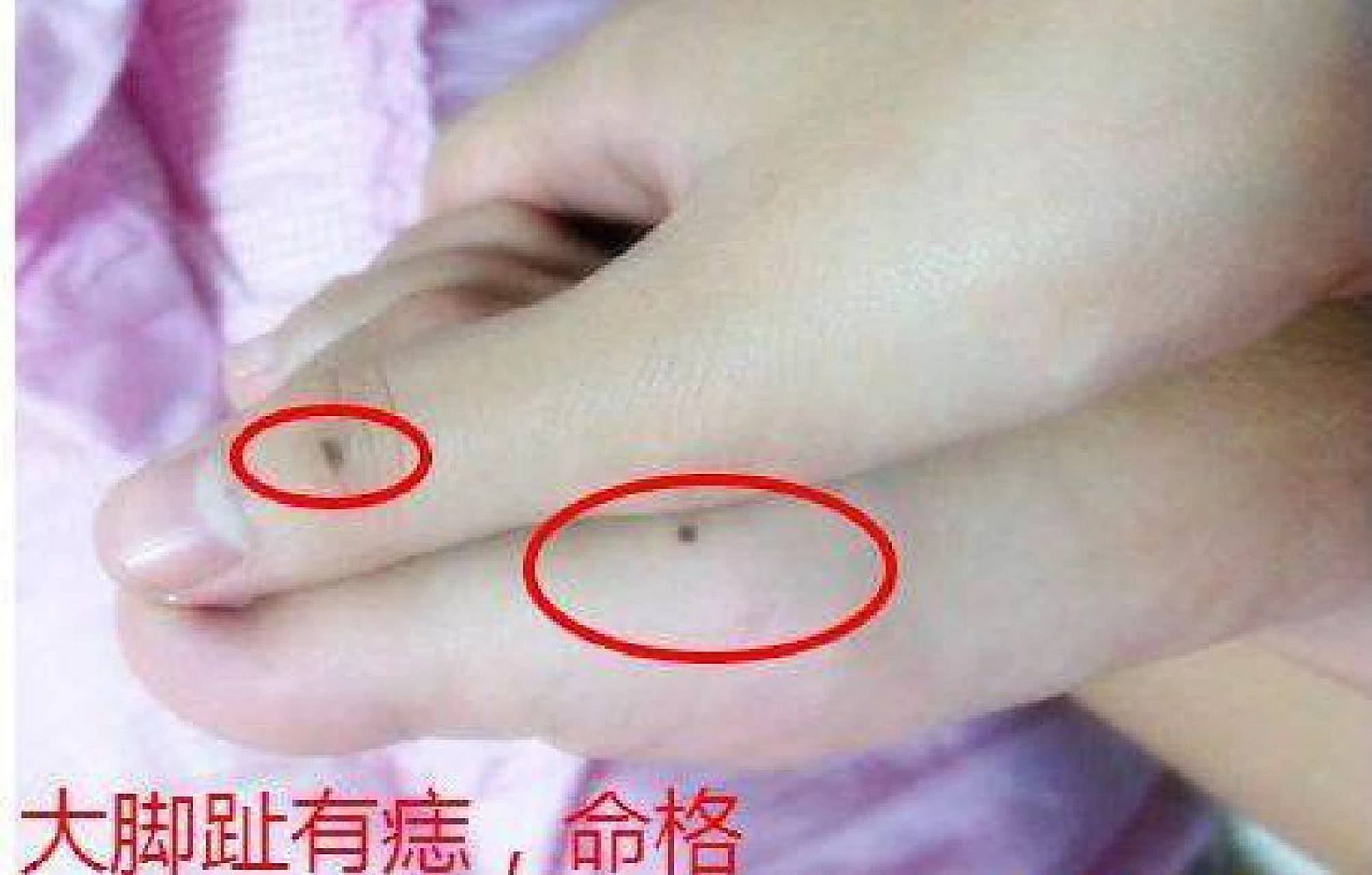 指缝有痣的人,对于积攒前才有特殊的嗜好,他们往往在不经意间已经拥有