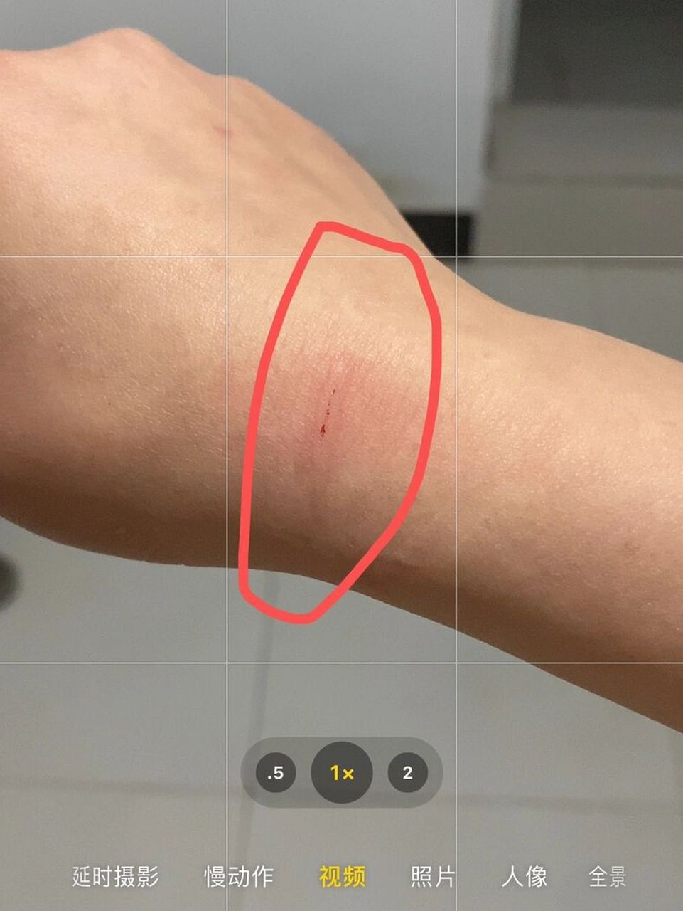 被狗牙划伤了  要不要打狂犬?